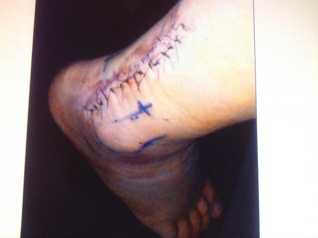 post-3498-0-09332300-1358212588_thumb.jp