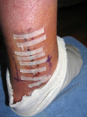 post-3498-0-15084300-1358969760_thumb.jp