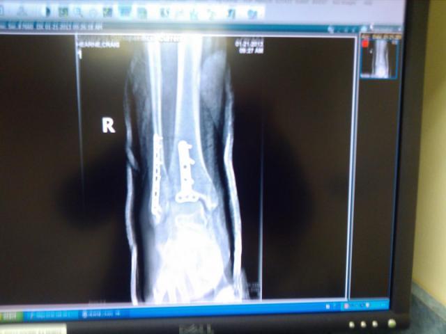 post-3498-0-20512200-1358904356_thumb.jp