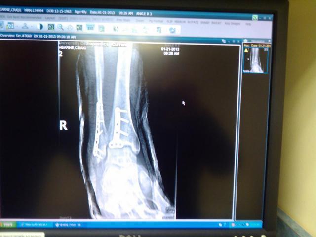 post-3498-0-40665800-1358904324_thumb.jp