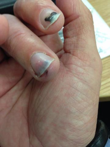 post-14145-0-52699400-1427117035_thumb.j