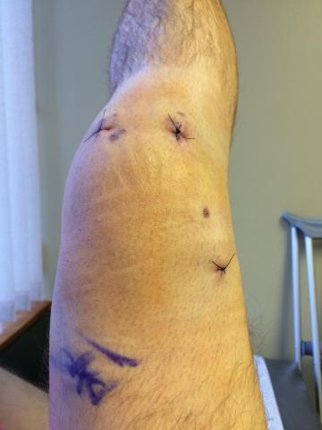 post-14606-0-08598500-1429547077_thumb.j