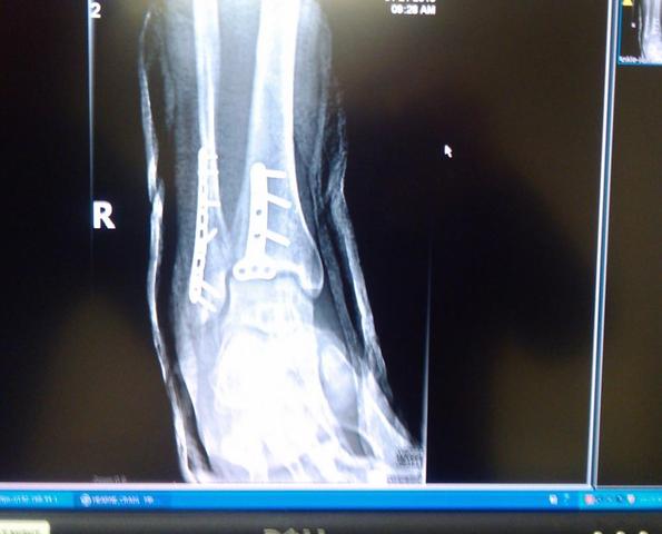 094_(2).thumb.jpg.b487149a9604c58716d8a0