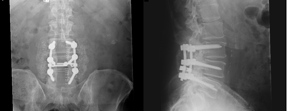 Bobs_spine1.thumb.png.537ddee5ff3361af03