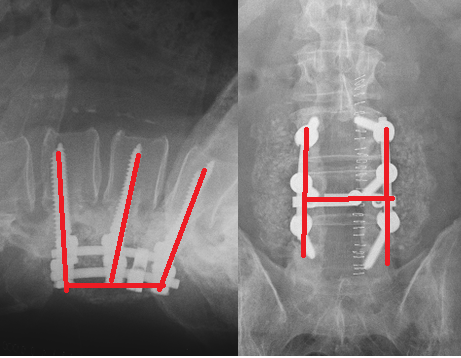 back1.png.acfcd6d0ddf8fcfcff4697425ddbe8