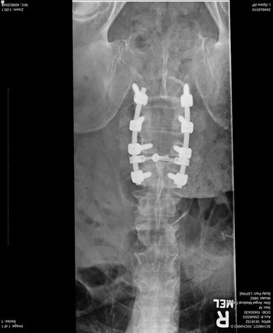 568afcc858637_xray1.thumb.jpg.9ef91de10c