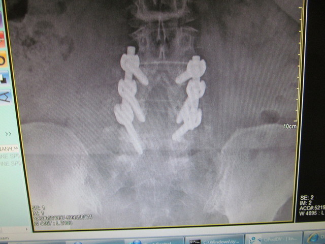 IMG_5270.thumb.JPG.c83b79edb890d56f0d026