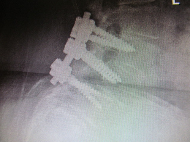 IMG_5271.thumb.JPG.00c689f97a4d6b9f86e00